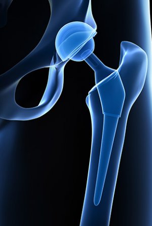 Pega Medical