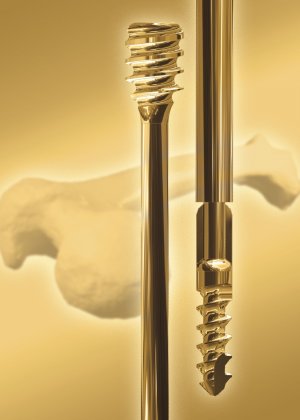 Pega Medical