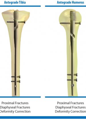 Pega Medical
