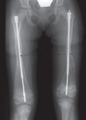 Pega Medical