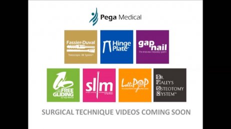 Pega Medical