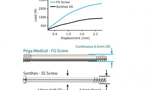 Biomechanics of the Free-Gliding SCFE Screw