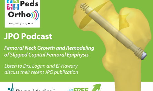 Ped Ortho Podcast – SCFE Growth and Remodeling